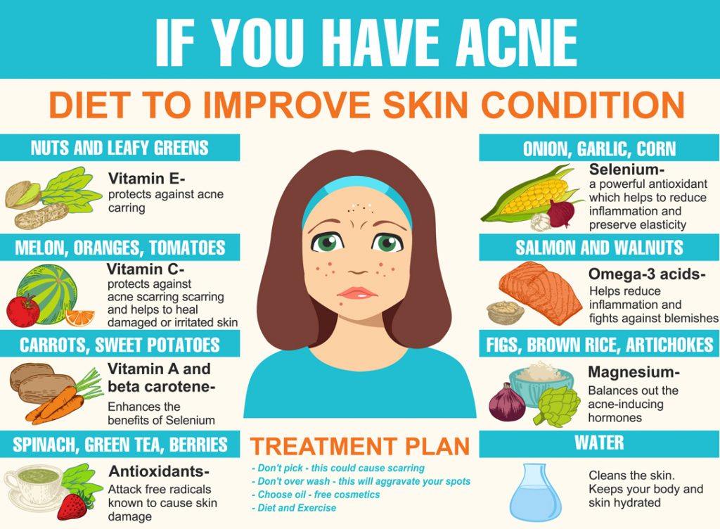 How your diet can impact acne